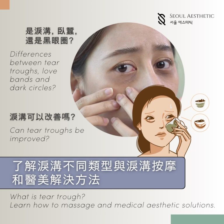 Tear Trough Correction