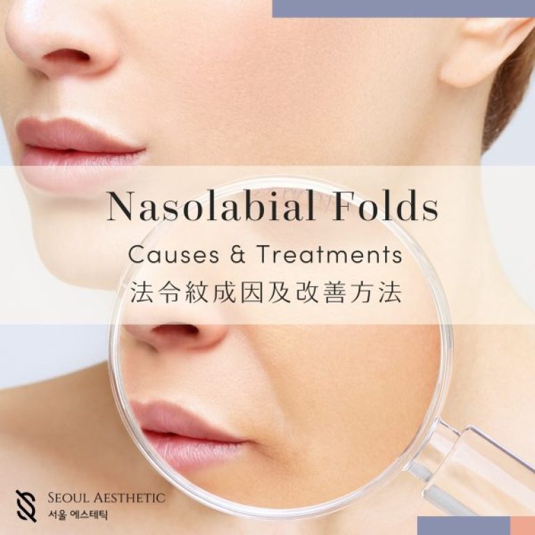 nasolabial folds causes and treatments